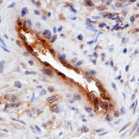 Immunohistochemistry SMOC-2 Antibody (667713)