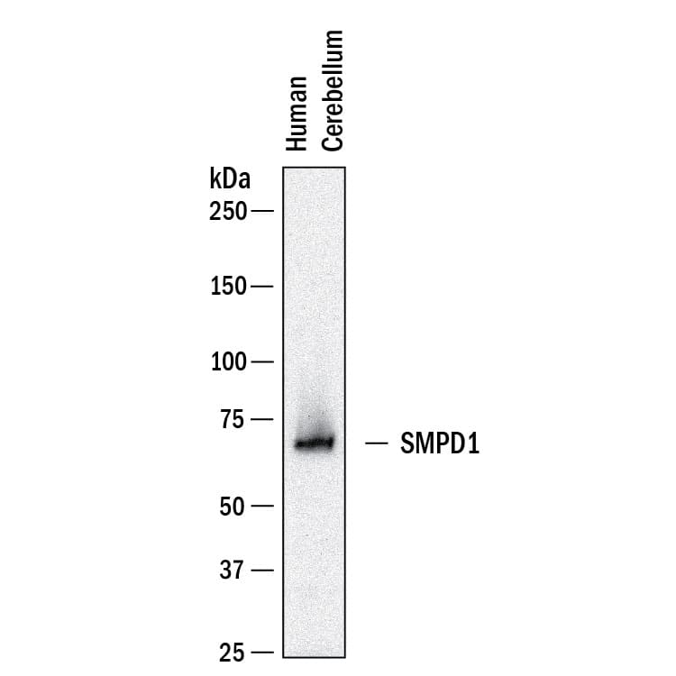Western blot shows lysates of human cerebellum tissue. PVDF membrane was probed with 1 µg/mL of Goat Anti-Human SMPD1 Antigen Affinity-purified Polyclonal Antibody (Catalog # AF5348) followed by HRP-conjugated Anti-Goat IgG Secondary Antibody (Catalog # HAF019). A specific band was detected for SMPD1 at approximately 70 kDa (as indicated). This experiment was conducted under reducing conditions and using Western Blot Buffer Group 1.