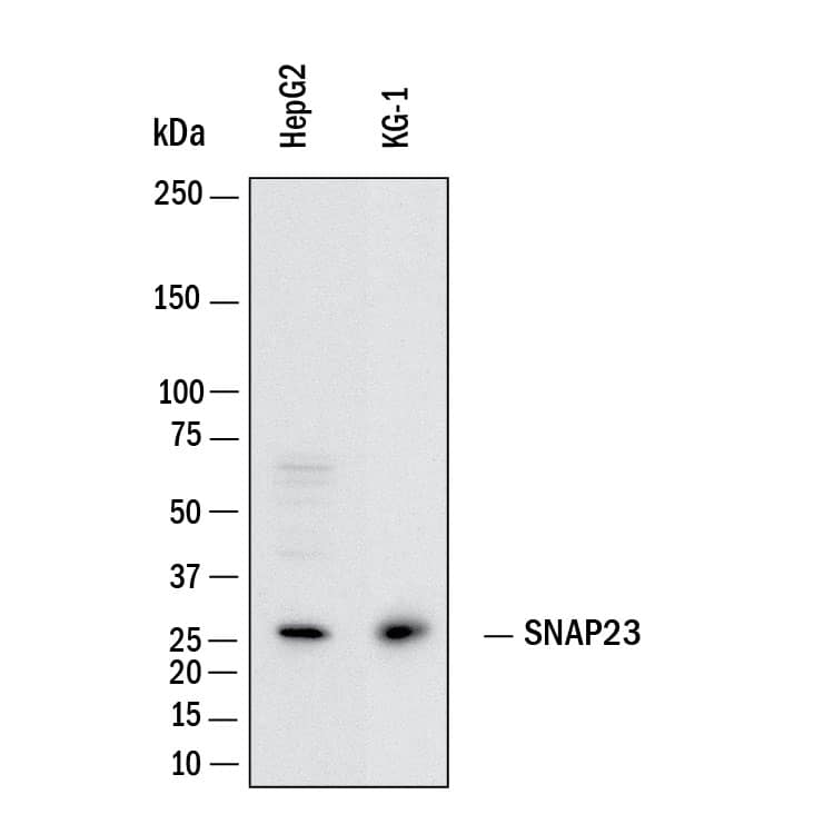 Western Blot SNAP23 Antibody [Unconjugated]