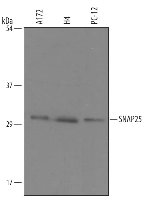 Western blot shows lysates of A172 human glioblastoma cell line, H4 human neuroglioma cell line, and PC-12 rat adrenal pheochromocytoma cell line. PVDF Membrane was probed with 1 µg/mL of Sheep Anti-Human/Mouse/Rat SNAP25 Antigen Affinity-purified Polyclonal Antibody (Catalog # AF5946) followed by HRP-conjugated Anti-Sheep IgG Secondary Antibody (HAF016). A specific band was detected for SNAP25 at approximately 29 kDa (as indicated). This experiment was conducted under reducing conditions and using Immunoblot Buffer Group 8.
