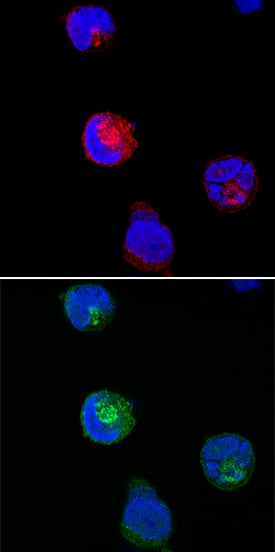 Immunocytochemistry SNAP29 Antibody