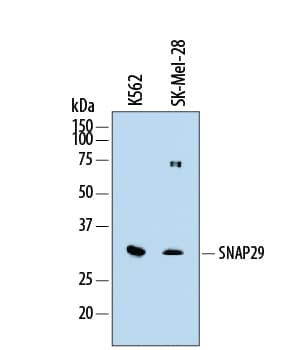 Western Blot SNAP29 Antibody