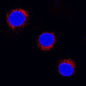 Immunocytochemistry SOCS-5 Antibody [Unconjugated]