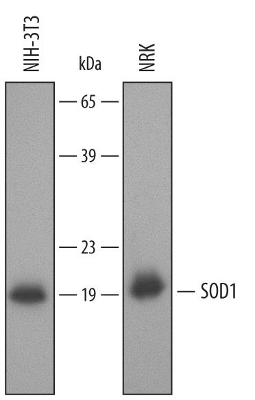 Western Blot SOD1/Cu-Zn SOD Antibody [Unconjugated]