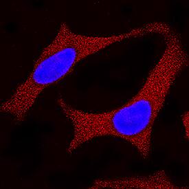 SOD1/Cu-Zn SOD was detected in immersion fixed HeLa human cervical epithelial carcinoma cell line using Mouse Anti-Human SOD1/Cu-Zn SOD Monoclonal Antibody (Catalog # MAB3418) at 25 µg/mL for 3 hours at room temperature. Cells were stained using the NorthernLights™ 557-conjugated Anti-Mouse IgG Secondary Antibody (red; Catalog # NL007) and counterstained with DAPI (blue). Specific staining was localized to cytoplasm. View our protocol for Fluorescent ICC Staining of Cells on Coverslips.