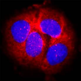 SOD2/Mn-SOD was detected in immersion fixed MCF-7 human breast cancer cell line using Mouse Anti-Human/Mouse/Rat SOD2/Mn-SOD Monoclonal Antibody (Catalog # MAB3419) at 25 µg/mL for 3 hours at room temperature. Cells were stained using the NorthernLights™ 557-conjugated Anti-Mouse IgG Secondary Antibody (red; Catalog # NL007) and counterstained with DAPI (blue). Specific staining was localized to cytoplasm. View our protocol for Fluorescent ICC Staining of Cells on Coverslips.
