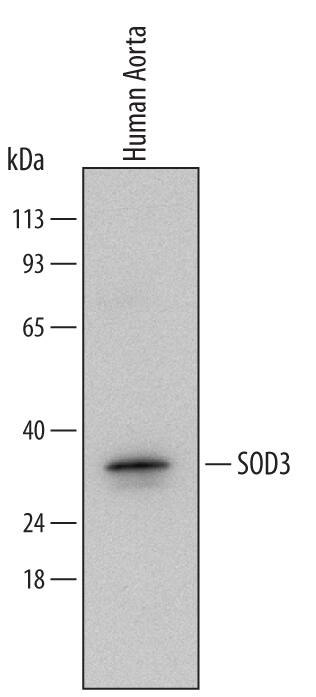 Western blot shows lysates of human aorta tissue. PVDF Membrane was probed with 0.2 µg/mL of Goat Anti-Human SOD3/EC-SOD Antigen Affinity-purified Polyclonal Antibody (Catalog # AF3420) followed by HRP-conjugated Anti-Goat IgG Secondary Antibody (Catalog # HAF017). A specific band was detected for SOD3/EC-SOD at approximately 30 kDa (as indicated). This experiment was conducted under reducing conditions and using Immunoblot Buffer Group 2.
