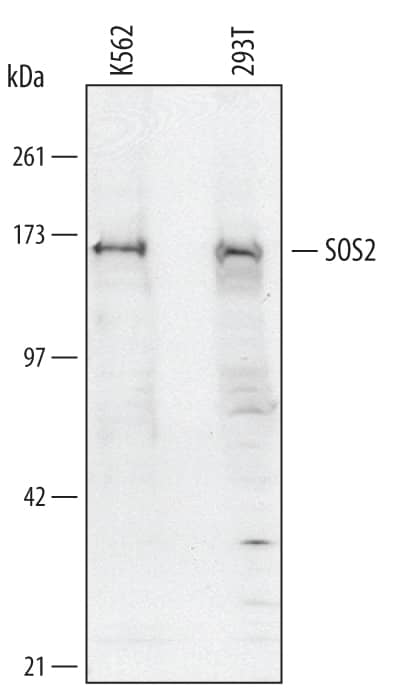 Western Blot SOS2 Antibody [Unconjugated]