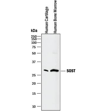 Western blot shows lysates of human cartilage tissue and human bone marrow. PVDF membrane was probed with 2 µg/mL of Goat Anti-Human SOST/Sclerostin Antigen Affinity-purified Polyclonal Antibody (Catalog # AF1406) followed by HRP-conjugated Anti-Goat IgG Secondary Antibody (Catalog # HAF017). A specific band was detected for SOST/Sclerostin at approximately 28 kDa (as indicated). This experiment was conducted under reducing conditions and using Immunoblot Buffer Group 1.
