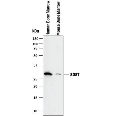 Western blot shows lysates of human bone marrow and mouse bone marrow. PVDF membrane was probed with 2 µg/mL of Goat Anti-Mouse SOST/Sclerostin Antigen Affinity-purified Polyclonal Antibody (Catalog # AF1589) followed by HRP-conjugated Anti-Goat IgG Secondary Antibody (Catalog # HAF017). A specific band was detected for SOST/Sclerostin at approximately 28 kDa (as indicated). This experiment was conducted under reducing conditions and using Immunoblot Buffer Group 1.