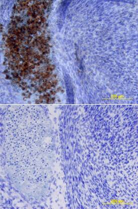SOST/Sclerostin was detected in immersion fixed frozen sections of mouse embryo using Goat Anti-Mouse SOST/Sclerostin Biotinylated Antigen Affinity-purified Polyclonal Antibody (Catalog # BAF1589) at 15 µg/mL overnight at 4 °C. Tissue was stained using the Anti-Goat HRP-DAB Cell & Tissue Staining Kit (brown; Catalog # CTS008) and counterstained with hematoxylin (blue). Lower panel shows a lack of labeling if primary antibodies are omitted and tissue is stained only with secondary antibody followed by incubation with detection reagents. View our protocol for Chromogenic IHC Staining of Frozen Tissue Sections.