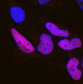 Immunocytochemistry SOX10 Antibody [Unconjugated]