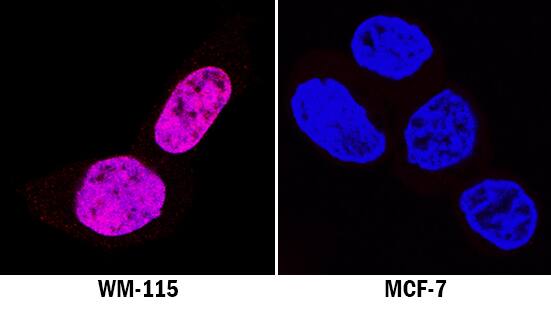 SOX10 was detected in immersion fixed WM-115 human malignant melanoma cell line (positive stain) and MCF-7 human breast cancer cell line (negative stain) using Mouse Anti-Human SOX10 Monoclonal Antibody (Catalog # MAB28641) at 8 µg/mL for 3 hours at room temperature. Cells were stained using the NorthernLights™ 557-conjugated Anti-Mouse IgG Secondary Antibody (red; Catalog # NL007) and counterstained with DAPI (blue). Specific staining was localized to nuclei. View our protocol for Fluorescent ICC Staining of Cells on Coverslips.