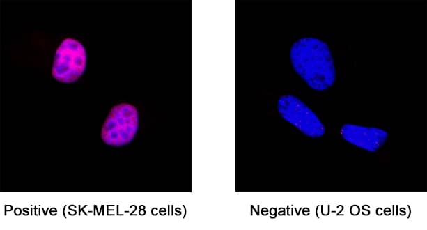 SOX10 was detected in immersion fixed SK-Mel-28 human malignant melanoma cell line (positive stain) and U2OS human osteosarcoma cell line (negative stain) using Mouse Anti-Human SOX10 Monoclonal Antibody (Catalog # MAB28643) at 8 µg/mL for 3 hours at room temperature. Cells were stained using the NorthernLights™ 557-conjugated Anti-Mouse IgG Secondary Antibody (red; Catalog # NL007) and counterstained with DAPI (blue). Specific staining was localized to cell nuclei. View our protocol for Fluorescent ICC Staining of Cells on Coverslips.
