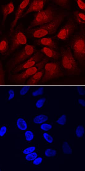 SOX11 was detected in immersion fixed HeLa human cervical epithelial carcinoma cell line using Sheep Anti-Human SOX11 Antigen Affinity-purified Polyclonal Antibody (Catalog # AF3976) at 10 µg/mL for 3 hours at room temperature. Cells were stained using the NorthernLights™ 557-conjugated Anti-Sheep IgG Secondary Antibody (red, upper panel; Catalog # NL010) and counterstained with DAPI (blue, lower panel). Specific staining was localized to nuclei and cytoplasm. View our protocol for Fluorescent ICC Staining of Cells on Coverslips.
