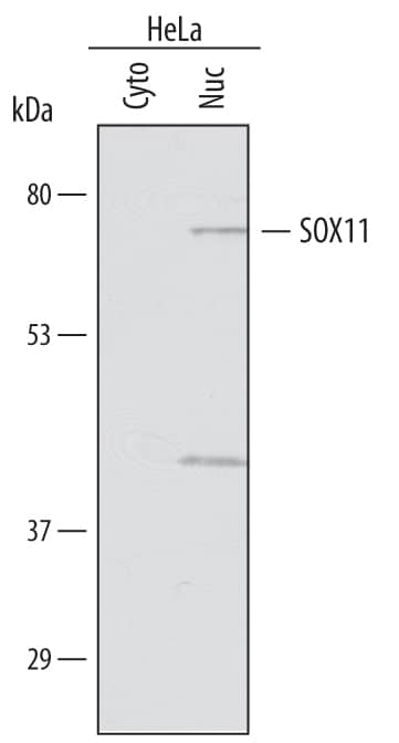 Western blot shows lysates of HeLa human cervical epithelial carcinoma cell line. Gels were loaded with 25 µg of cytoplasmic (Cyto) and 25 µg of nuclear (Nuc) extracts. PVDF membrane was probed with 1 µg/mL of Sheep Anti-Human SOX11 Antigen Affinity-purified Polyclonal Antibody (Catalog # AF3976) followed by HRP-conjugated Anti-Sheep IgG Secondary Antibody (Catalog # HAF016). A specific band was detected for SOX11 at approximately 70 kDa (as indicated). This experiment was conducted under reducing conditions and using Immunoblot Buffer Group 1.