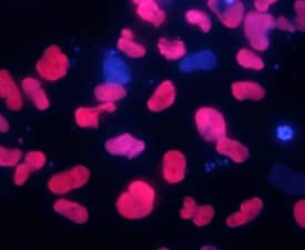 SOX17 was detected in immersion fixed B16 mouse melanoma cell line using 10 µg/mL Goat Anti-Human SOX17 Antigen Affinity-purified Polyclonal Antibody (Catalog # AF1924) for 3 hours at room temperature. Cells were stained with the NorthernLights™ 557-conjugated Anti-Goat IgG Secondary Antibody (red; NL001) and counter-stained with DAPI (blue). View our protocol for Fluorescent ICC Staining of Cells on Coverslips.