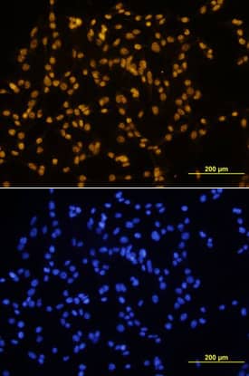 SOX17 was detected in immersion fixed B16 mouse melanoma cell line using Mouse Anti-Human SOX17 Monoclonal Antibody (Catalog # MAB1924) at 10 µg/mL for 3 hours at room temperature. Cells were stained using the NorthernLights™ 557-conjugated Anti-Mouse IgG Secondary Antibody (yellow, upper panel; Catalog # NL007) and counterstained with DAPI (blue, lower panel). View our protocol for Fluorescent ICC Staining of Cells on Coverslips.