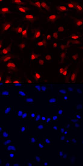 Immunocytochemistry SOX1 Antibody [Unconjugated]