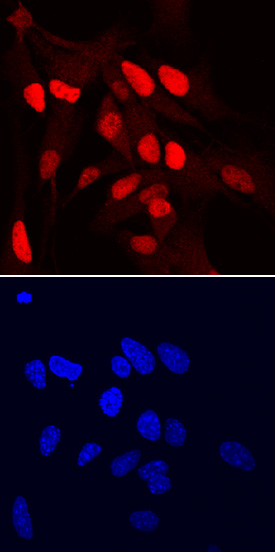 SOX1 was detected in immersion fixed mouse cortical stem cells (Catalog # NSC002) using Goat Anti-Human/Mouse/Rat SOX1 Antigen Affinity-purified Polyclonal Antibody (Catalog # AF3369) at 10 µg/mL for 3 hours at room temperature. Cells were stained using the NorthernLights™ 557-conjugated Anti-Goat IgG Secondary Antibody (red, upper panel; NL001) and counterstained with DAPI (blue, lower panel). Specific staining was localized to nuclei. View our protocol for Fluorescent ICC Staining of Cells on Coverslips.