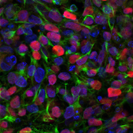 SOX1 was detected in immersion fixed BG01V human embryonic stem cells differentiated into neural progenitor cells using Goat Anti-Human/Mouse/Rat SOX1 Antigen Affinity-purified Polyclonal Antibody (Catalog # AF3369) at 10 µg/mL for 3 hours at room temperature. Cells were stained using the NorthernLights™ 557-conjugated Anti-Goat IgG Secondary Antibody (red; NL001) and counterstained with DAPI (blue). Nestin was also detected using Mouse Anti-Mouse/Rat Nestin Monoclonal Antibody (MAB2736) and stained using the NorthernLights™ 493-conjugated Anti-Mouse IgG Secondary Antibody (green; Catalog # NL009). Specific staining of SOX1 was localized to nuclei. View our protocol for Fluorescent ICC Staining of Stem Cells on Coverslips.