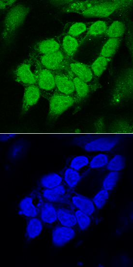 SOX1 was detected in immersion fixed NTera-2 human testicular embryonic carcinoma cell line differentiated with retinoic acid using Goat Anti-Human/Mouse/Rat SOX1 Antigen Affinity-purified Polyclonal Antibody (Catalog # AF3369) at 10 µg/mL for 3 hours at room temperature. Cells were stained using the NorthernLights™ 493-conjugated Anti-Goat IgG Secondary Antibody (green, upper panel; NL003) and counterstained with DAPI (blue, lower panel). View our protocol for Fluorescent ICC Staining of Cells on Coverslips.
