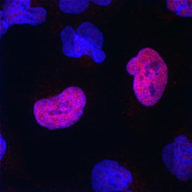 Immunocytochemistry SOX21 Antibody [Unconjugated]