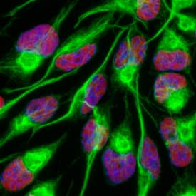 SOX2 was detected in immersion fixed undifferentiated rat cortical stem cells using Goat Anti-Human/Mouse/Rat SOX2 Antigen Affinity-purified Polyclonal Antibody (Catalog # AF2018) at 10 µg/mL for 3 hours at room temperature. Cells were stained using the NorthernLights™ 557-conjugated Anti-Goat IgG Secondary Antibody (red; NL001) and counterstained with DAPI (blue). Nestin was also detected using Mouse Anti-Mouse/Rat Nestin Monoclonal Antibody (MAB2736) and stained using the NorthernLights™ 493-conjugated Anti-Mouse IgG Secondary Antibody (green; NL009). Specific staining of SOX2 was localized to nuclei. View our protocol for Fluorescent ICC Staining of Stem Cells on Coverslips.