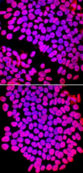 SOX2 was detected in immersion fixed ADLF1 (top panel) and FAB2 (bottom panel) induced pluripotent stem cell lines using Goat Anti-Human/Mouse/Rat SOX2 Antigen Affinity-purified Polyclonal Antibody (Catalog # AF2018) at 10 µg/mL for 3 hours at room temperature. Cells were stained using the NorthernLights™ 557-conjugated Anti-Goat IgG Secondary Antibody (red; NL001) and counterstained with DAPI (blue). Specific staining was localized to nuclei. View our protocol for Fluorescent ICC Staining of Stem Cells on Coverslips.
