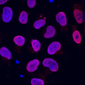SOX2 was detected in immersion fixed human plasmid-derived induced pluripotent stem cells (iPSK3) using Goat Anti-Human SOX2 Biotinylated Antigen Affinity-purified Polyclonal Antibody (Catalog # BAF2018) at 10 µg/mL for 3 hours at room temperature. Cells were stained using the NorthernLights™ 557-conjugated Streptavidin (red; Catalog # NL999) and counterstained with DAPI (blue). Specific staining was localized to nuclei. View our protocol for Fluorescent ICC Staining of Stem Cells on Coverslips.