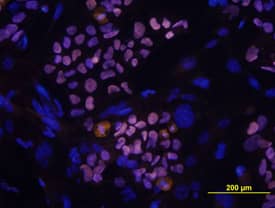 Immunocytochemistry SOX2 Antibody (245610) [Unconjugated]