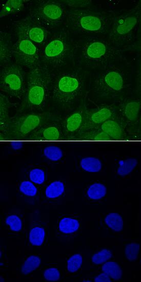 SOX3 was detected in immersion fixed NTera-2 human testicular embryonic carcinoma cell line differentiation with retinoic acid using Goat Anti-Human SOX3 Antigen Affinity-purified Polyclonal Antibody (Catalog # AF2569) at 10 µg/mL for 3 hours at room temperature. Cells were stained using the NorthernLights™ 493-conjugated Anti-Goat IgG Secondary Antibody (green, upper panel; NL003) and counterstained with DAPI (blue, lower panel). View our protocol for Fluorescent ICC Staining of Cells on Coverslips.