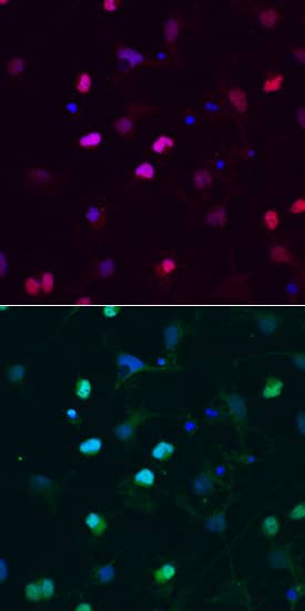 Immunocytochemistry SOX6 Antibody (667136)