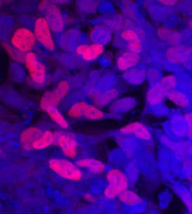 SOX9 was detected in immersion fixed BG01V human embryonic stem cells differentiated into early proximal lung progenitor cells using Goat Anti-Human SOX9 Antigen Affinity-purified Polyclonal Antibody (Catalog # AF3075) at 10 µg/mL for 3 hours at room temperature. Cells were stained using the NorthernLights™ 557-conjugated Anti-Goat IgG Secondary Antibody (red, upper panel; NL001) and counterstained with DAPI (blue, lower panel). Specific staining was localized to nuclei. View our protocol for Fluorescent ICC Staining of Stem Cells on Coverslips.