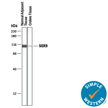 Simple Western lane view shows lysates of normal adjacent tissue and Crohns tissue, loaded at 0.2 mg/mL. A specific band was detected for SOX9 at approximately 107 kDa (as indicated) using 20 µg/mL of Goat Anti-Human SOX9 Antigen Affinity-purified Polyclonal Antibody (Catalog # AF3075) followed by 1:50 dilution of HRP-conjugated Anti-Goat IgG Secondary Antibody (HAF019). This experiment was conducted under reducing conditions and using the 12-230 kDa separation system.