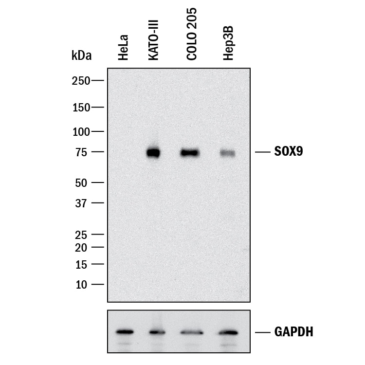 Western blot shows lysates of HeLa human cervical epithelial carcinoma cell line, KATO-III human gastric carcinoma cell line, COLO 205 human colorectal adenocarcinoma cell line, and Hep3B human hepatocellular carcinoma cell line. PVDF membrane was probed with 0.5 µg/mL of Goat Anti-Human SOX9 Antigen Affinity-purified Polyclonal Antibody (Catalog # AF3075) followed by HRP-conjugated Anti-Goat IgG Secondary Antibody (HAF017). A specific band was detected for SOX9 at approximately 75 kDa (as indicated). GAPDH (Catalog # AF5718) is shown as a loading control. This experiment was conducted under reducing conditions and using Immunoblot Buffer Group 1.