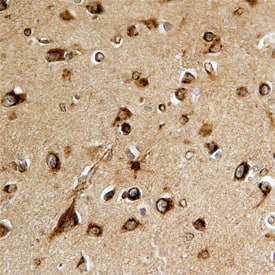 SPARC-like 1/SPARCL1 was detected in immersion fixed paraffin-embedded sections of human brain using Goat Anti-Human SPARC-like 1/SPARCL1 Antigen Affinity-purified Polyclonal Antibody (Catalog # AF2728) at 15 µg/mL overnight at 4 °C. Before incubation with the primary antibody, tissue was subjected to heat-induced epitope retrieval using Antigen Retrieval Reagent-Basic (Catalog # CTS013). Tissue was stained using the Anti-Goat HRP-DAB Cell & Tissue Staining Kit (brown; Catalog # CTS008) and counterstained with hematoxylin (blue). Specific staining was localized to neurons. View our protocol for Chromogenic IHC Staining of Paraffin-embedded Tissue Sections.