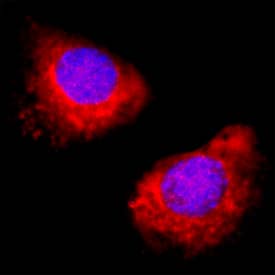 Immunocytochemistry SPARC Antibody [Unconjugated]