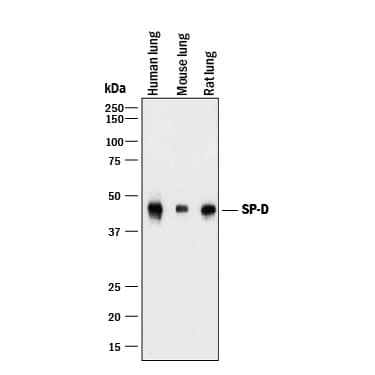 Western Blot SP-D Antibody [Unconjugated]