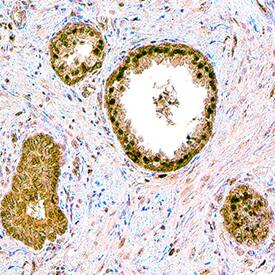 Sphingosine Kinase 1/SPHK1 was detected in immersion fixed paraffin-embedded sections of human prostate using Sheep Anti-Human Sphingosine Kinase 1/SPHK1 Antigen Affinity-purified Polyclonal Antibody (Catalog # AF5536) at 15 µg/mL overnight at 4 °C. Tissue was stained using the Anti-Sheep HRP-DAB Cell & Tissue Staining Kit (brown; Catalog # CTS019) and counterstained with hematoxylin (blue). Specific staining was localized to cytoplasm and nuclei of epithelial cells. View our protocol for Chromogenic IHC Staining of Paraffin-embedded Tissue Sections.