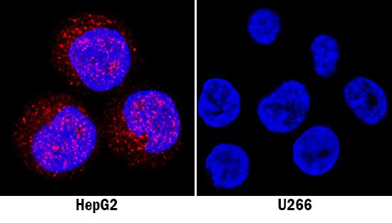 Sphingosine Kinase 1/SPHK1 was detected in immersion fixed HepG2 human hepatocellular carcinoma cell line (positive stain) and U266 human myeloma cell line (negative stain) using Mouse Anti-Human Sphingosine Kinase 1/SPHK1 Monoclonal Antibody (Catalog # MAB55361) at 8 µg/mL for 3 hours at room temperature. Cells were stained using the NorthernLights™ 557-conjugated Anti-Mouse IgG Secondary Antibody (red; Catalog # NL007) and counterstained with DAPI (blue). Specific staining was localized to nuclei and cytoplasm. View our protocol for Fluorescent ICC Staining of Cells on Coverslips.