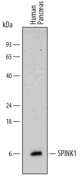 Western Blot SPINK1 Antibody [Unconjugated]