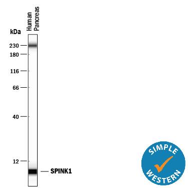 Simple Western lane view shows lysates of human pancreas tissue, loaded at 0.5 mg/mL. A specific band was detected for SPINK1 at approximately 6 kDa (as indicated) using 100 µg/mL of Mouse Anti-Human SPINK1 Monoclonal Antibody (Catalog # MAB7496). This experiment was conducted under reducing conditions and using the 12-230 kDa separation system. Non-specific interaction with the 230 kDa Simple Western standard may be seen with this antibody.