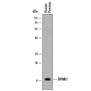 Western blot shows lysates of human pancreas tissue. PVDF membrane was probed with 2 µg/mL of Mouse Anti-Human SPINK1 Monoclonal Antibody (Catalog # MAB7496) followed by HRP-conjugated Anti-Mouse IgG Secondary Antibody (Catalog # HAF018). A specific band was detected for SPINK1 at approximately 6 kDa (as indicated). This experiment was conducted under reducing conditions and using Immunoblot Buffer Group 1.