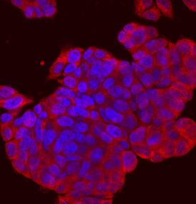 Immunocytochemistry SPRED2 Antibody
