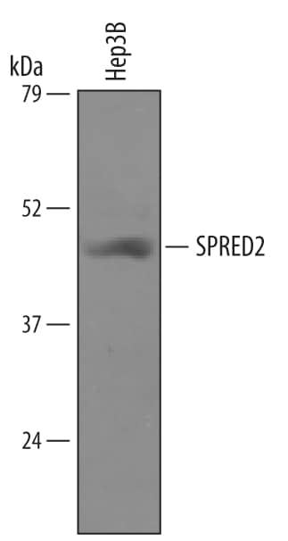 Western Blot SPRED2 Antibody