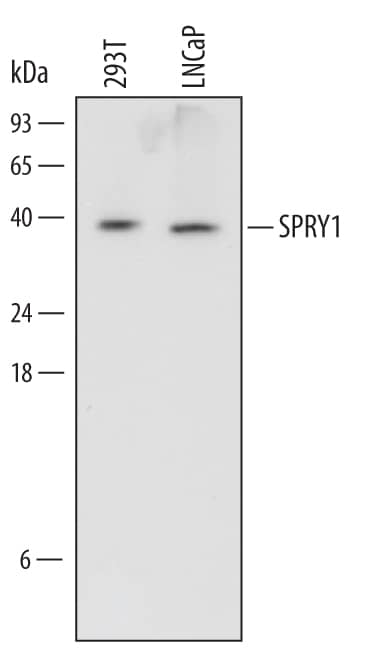 Western blot shows lysates of 293T human embryonic kidney cell line and LNCaP human prostate cancer cell line. PVDF Membrane was probed with 0.5 µg/mL of Human SPRY1 Monoclonal Antibody (Catalog # MAB6097) followed by HRP-conjugated Anti-Mouse IgG Secondary Antibody (Catalog # HAF007). A specific band was detected for SPRY1 at approximately 37 kDa (as indicated). This experiment was conducted under reducing conditions and using Immunoblot Buffer Group 1.
