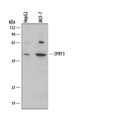 Western Blot SPRY3 Antibody [Unconjugated]