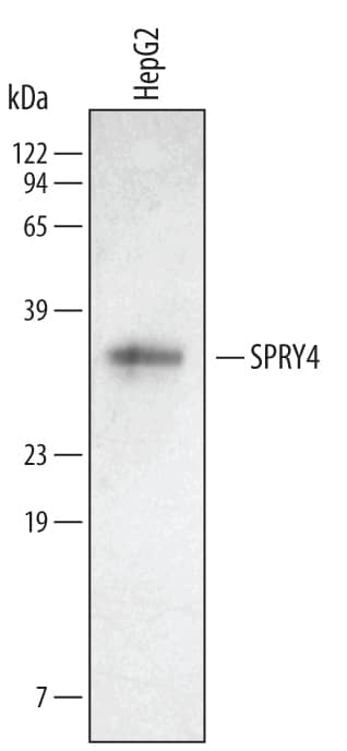Western Blot SPRY4 Antibody [Unconjugated]