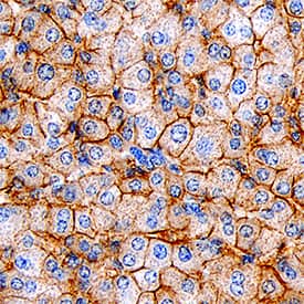 SR-BI was detected in immersion fixed paraffin-embedded sections of human liver using Mouse Anti-Human SR-BI Monoclonal Antibody (Catalog # MAB8114) at 15 µg/mL overnight at 4 °C. Tissue was stained using the Anti-Mouse HRP-DAB Cell & Tissue Staining Kit (brown; Catalog # CTS002) and counterstained with hematoxylin (blue). Specific staining was localized to cell membranes in hepatocytes. View our protocol for Chromogenic IHC Staining of Paraffin-embedded Tissue Sections.